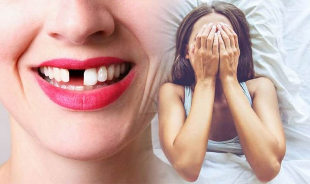 Những cặp số may mắn khi chiêm bao thấy gãy răng